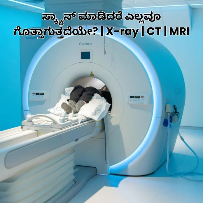 X-ray CT MRI Info